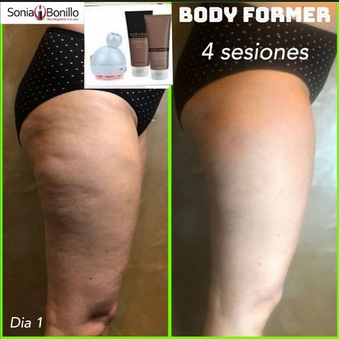 Testimonianza di dimagrimento