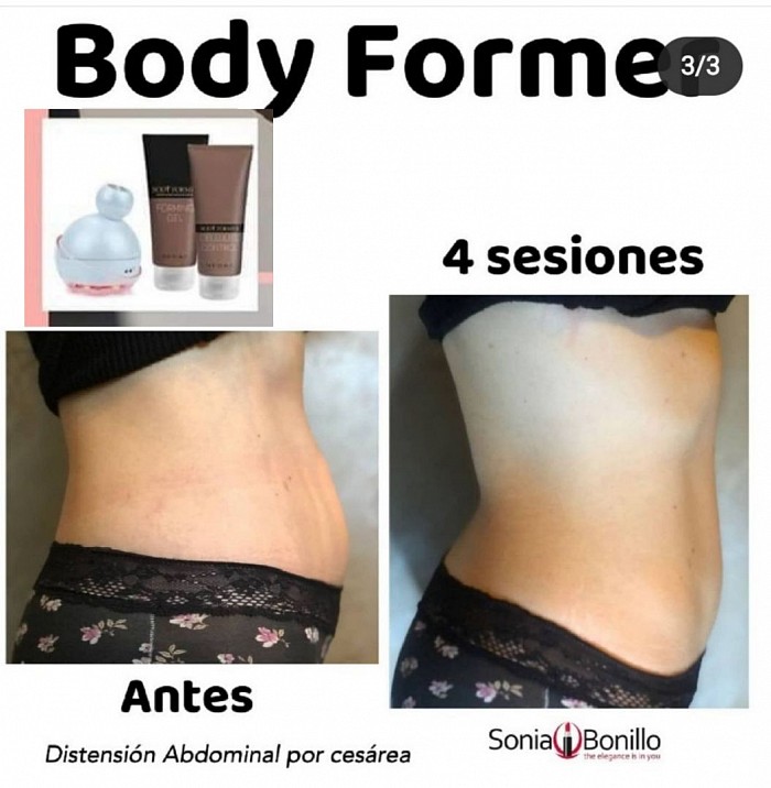 Testimonianza di dimagrimento